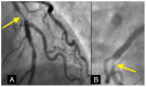 Figure 22