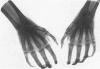 554