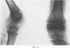 552