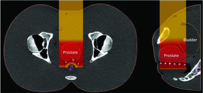 FIG. 2.