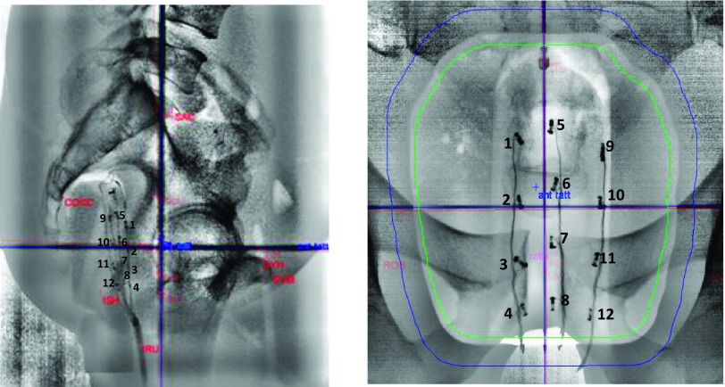 FIG. 3.