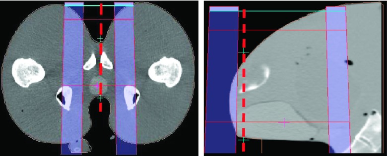 FIG. 10.