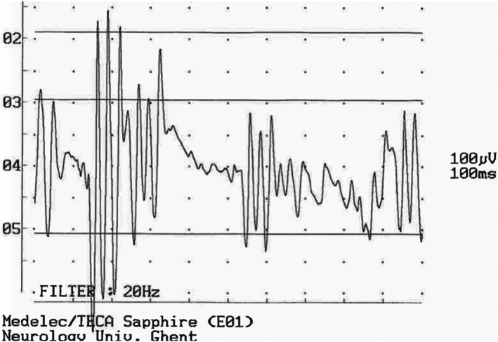FIGURE 4