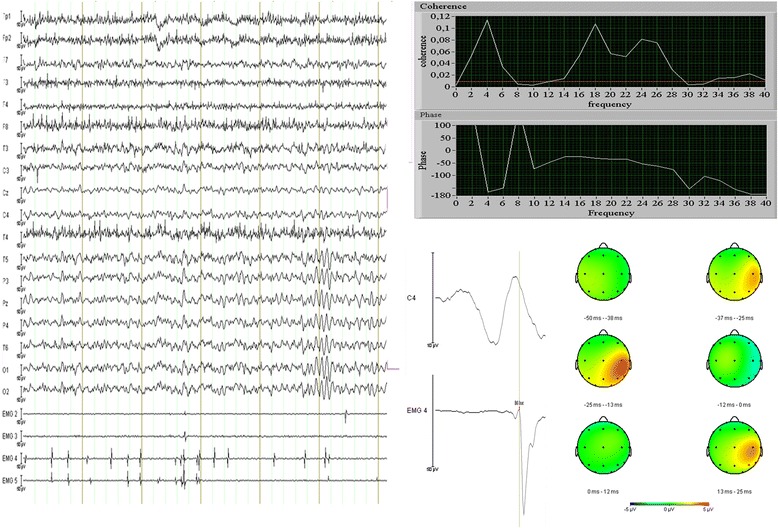 Fig. 1