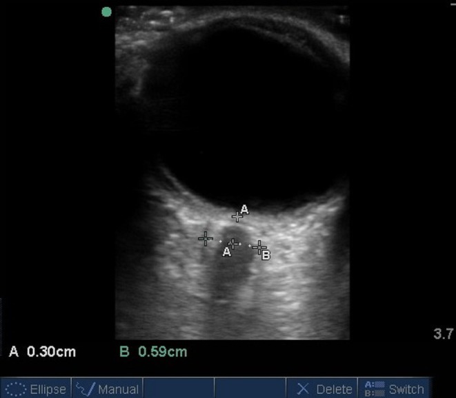 FIGURE 1