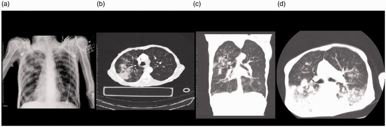 Figure 2.