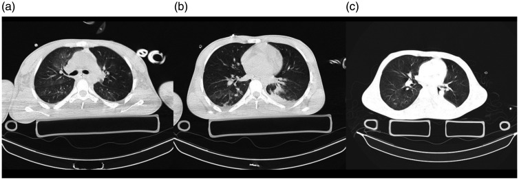 Figure 11.