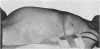 265