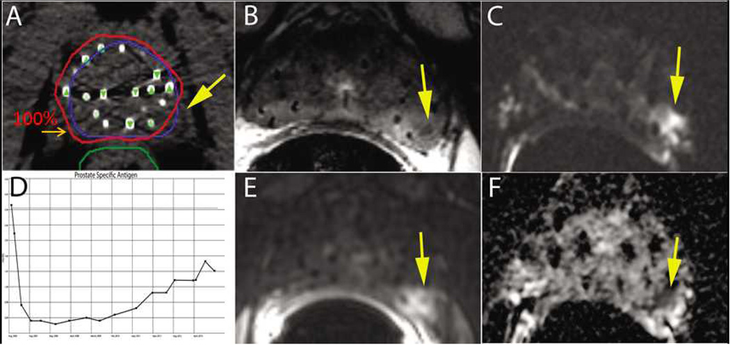 Fig 5