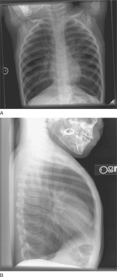 Figure 75-1