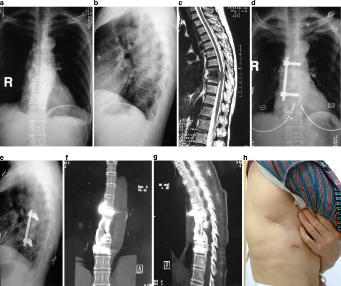 Fig.1