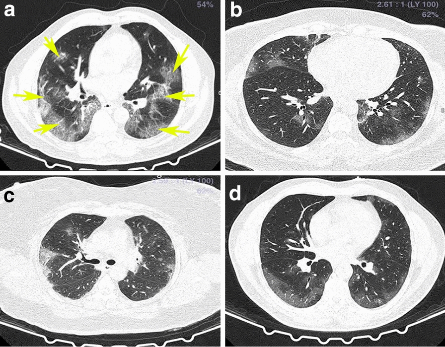 Fig. 1