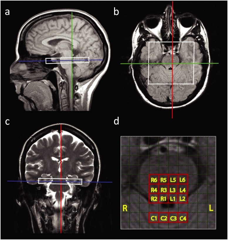 Fig 1