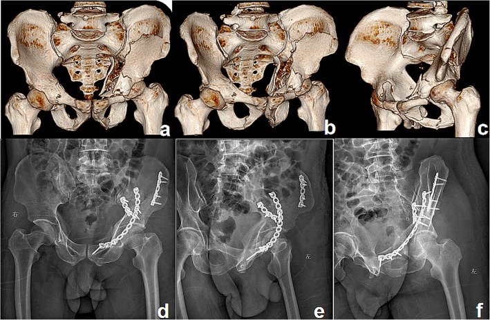 Fig. 3