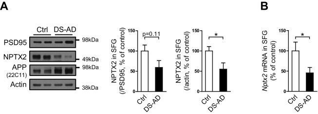 Figure 1—figure supplement 2.