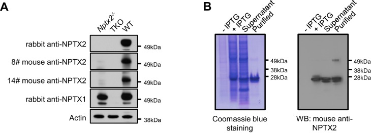 Figure 5—figure supplement 3.