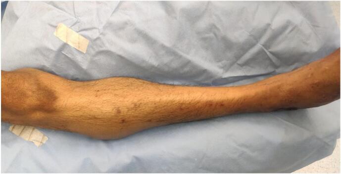 Fig. 7