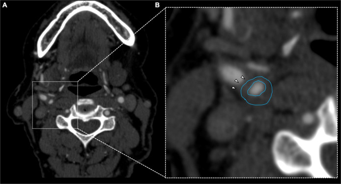 FIGURE 3