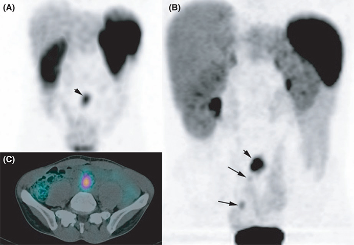 FIGURE 3