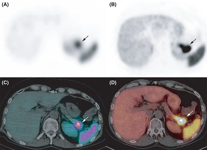 FIGURE 2