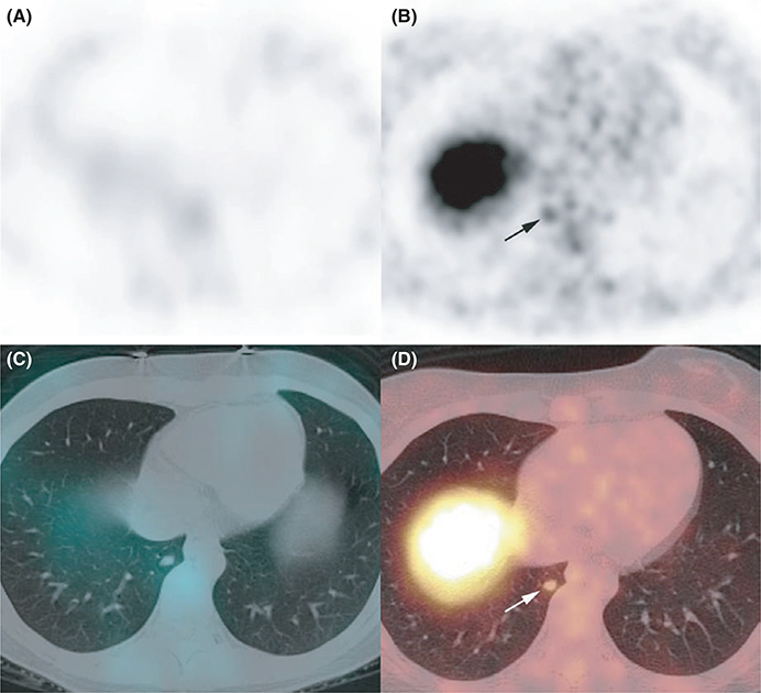 FIGURE 4