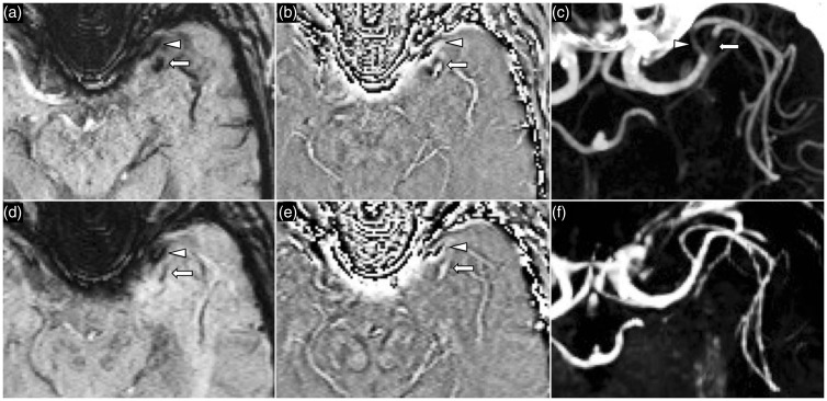 Figure 11.