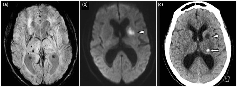 Figure 13.