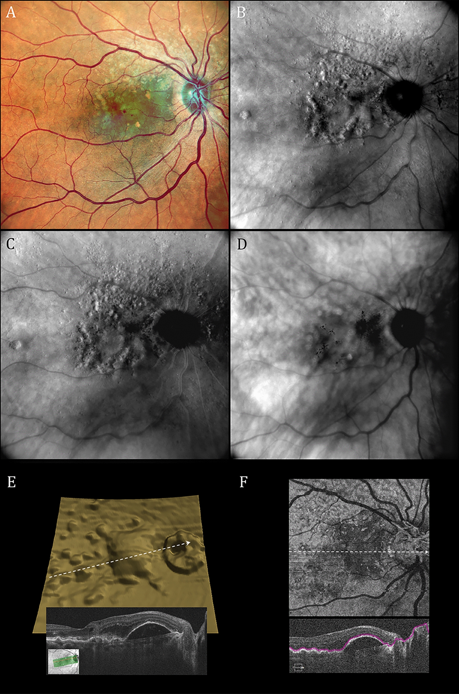 Fig. 1