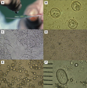 Fig 8.16