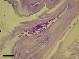 Fig 8.33