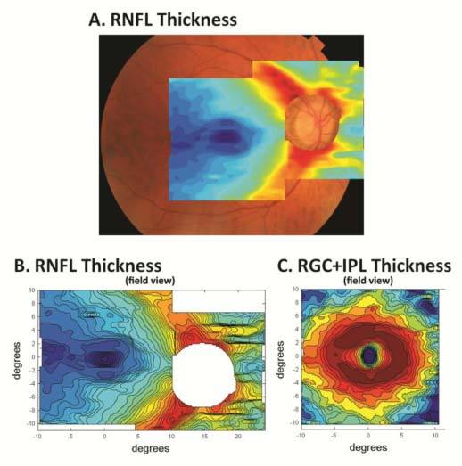 Fig. 2