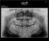 Fig. 2:
