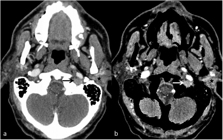 Figure 10.