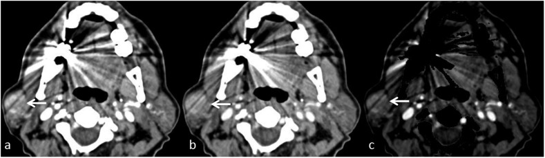 Figure 9.