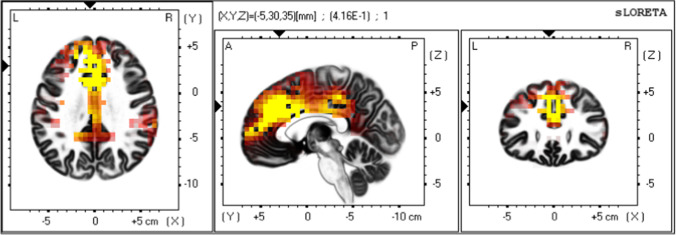 Fig. 4