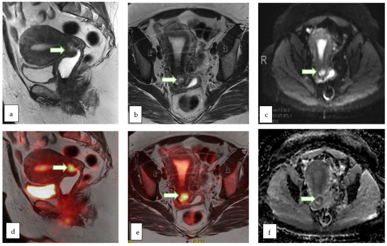 Figure 13