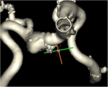 Fig. 14