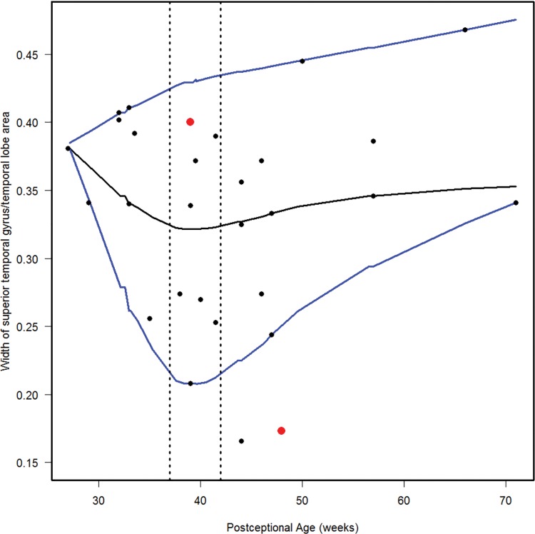 FIGURE 12