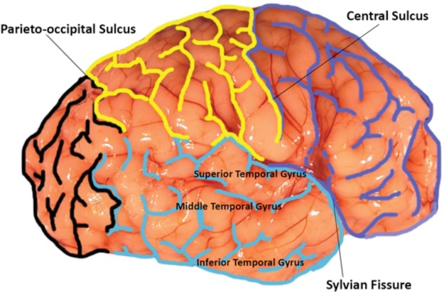 FIGURE 1