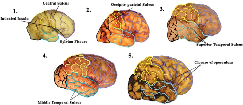 FIGURE 3