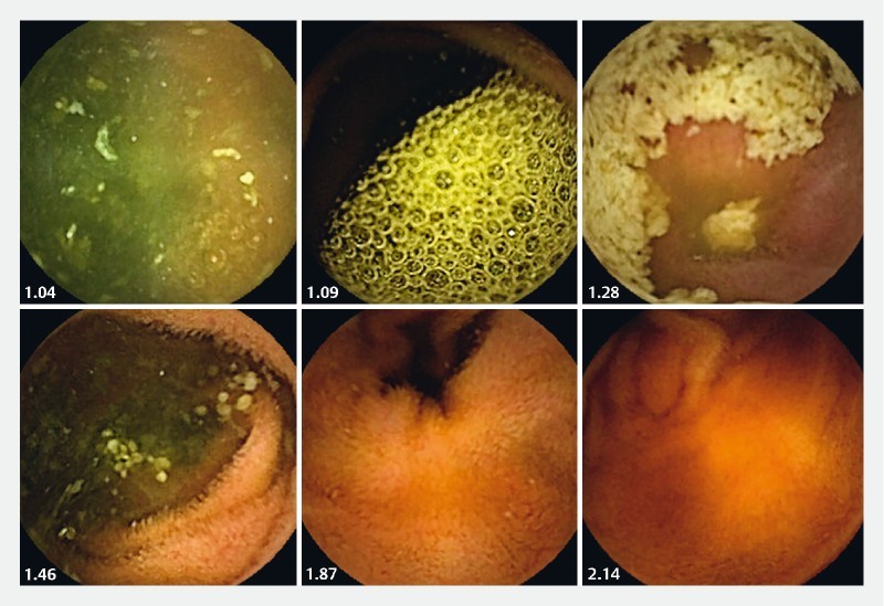 Fig. 2