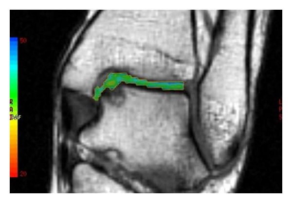 Figure 4