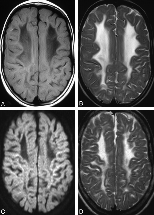 Fig 3.