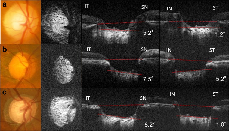 Fig. 2