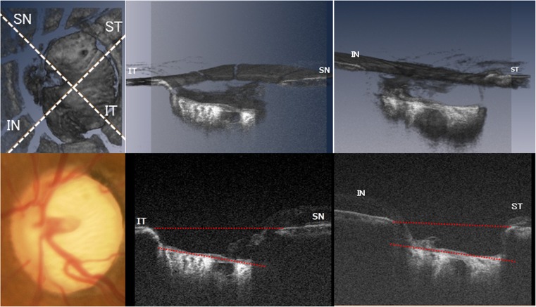 Fig. 1