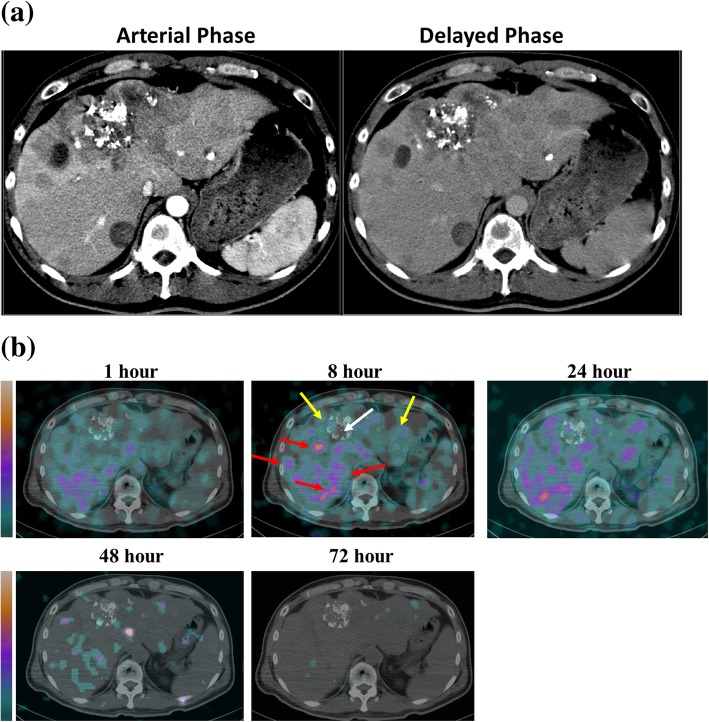 Fig. 2