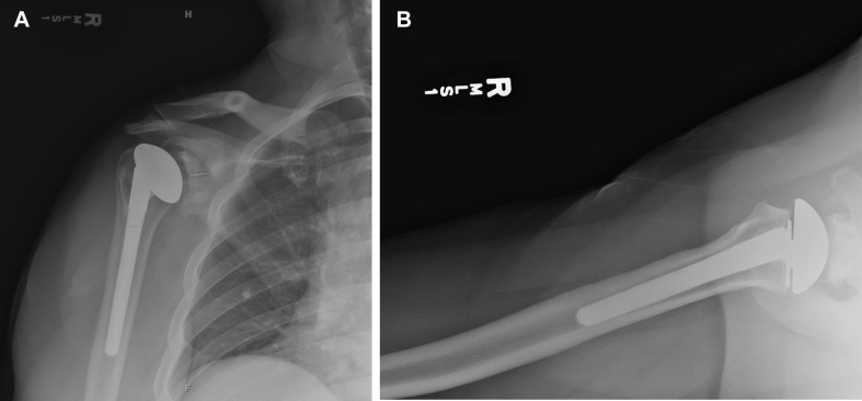 Figure 4