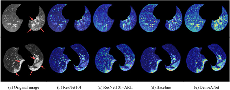 Fig. 11