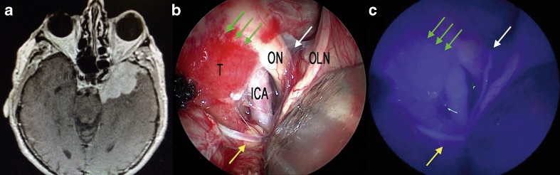 Fig. 10