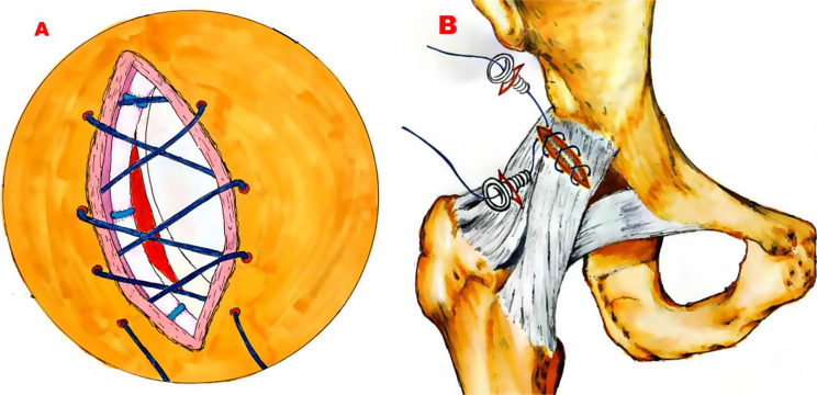 Fig. 2